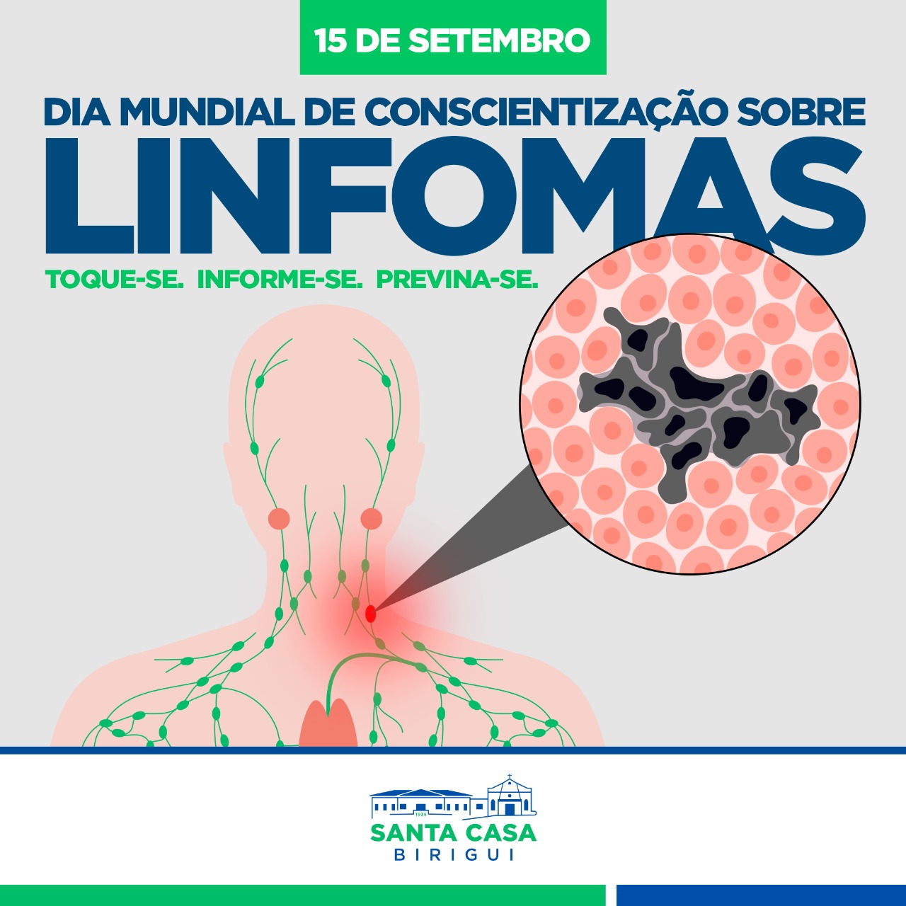15 de setembro – Dia Mundial de Conscientização sobre Linfomas